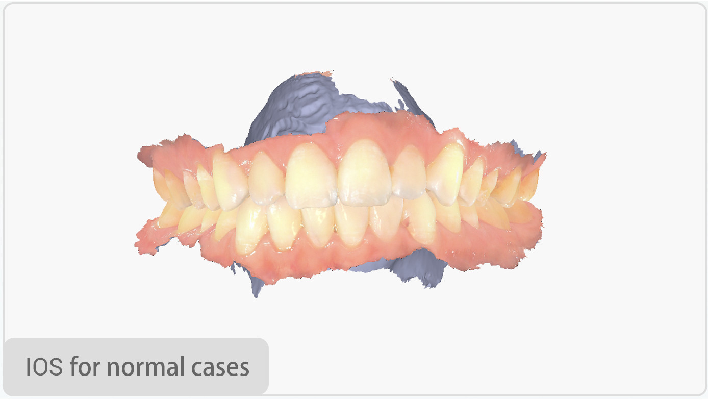 Aoralscan Elite